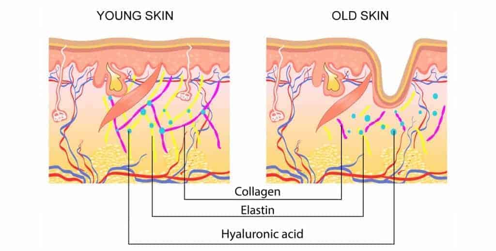 young-skin and old-skin